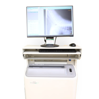 Computed radiography（CR）