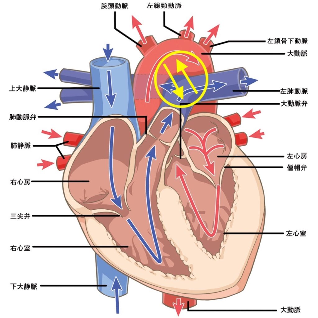 動脈管開存症の仕組み